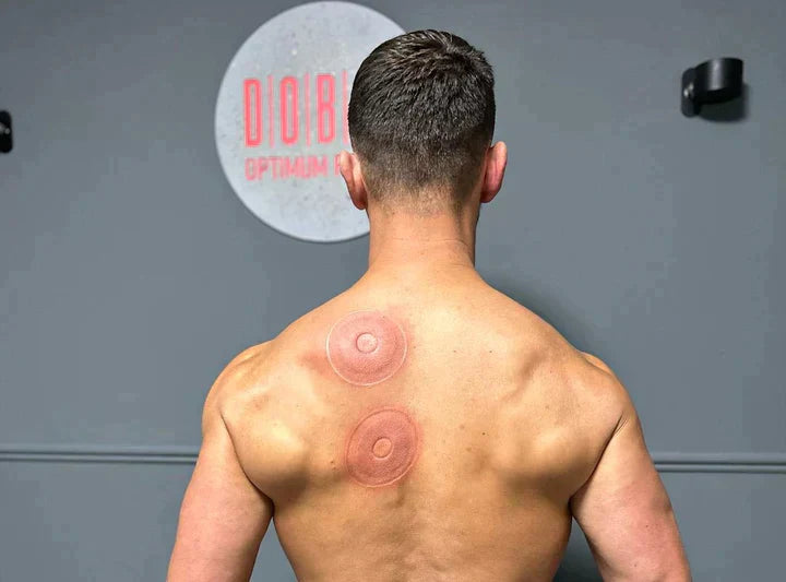 Smart Cupping Massager